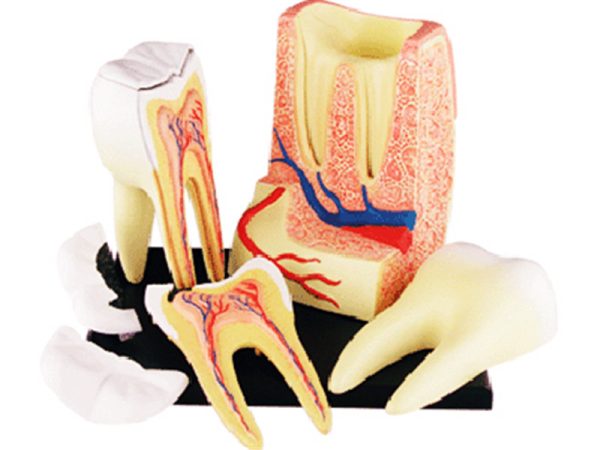 Triple root Molar Model